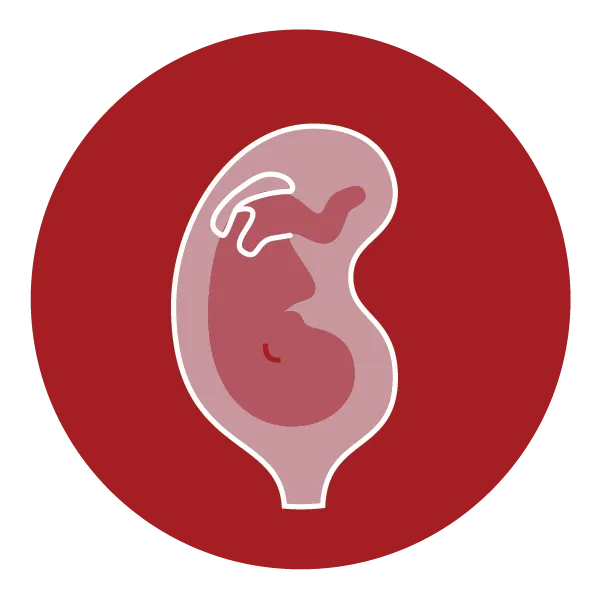 Preterm Birth